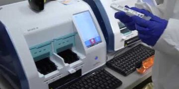 Tamponë të rinj e të shpejtë për Covid-19: 12 minuta për të përpunuar rezultatin e 6 testeve