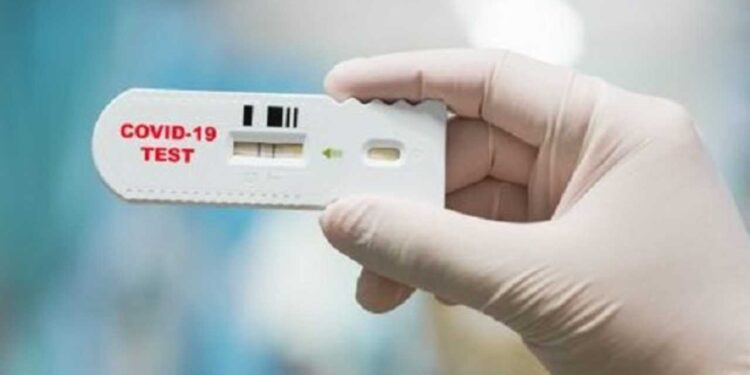 Testi i shpejtë covid edhe në farmaci, përjashtohen raste të dyshimta